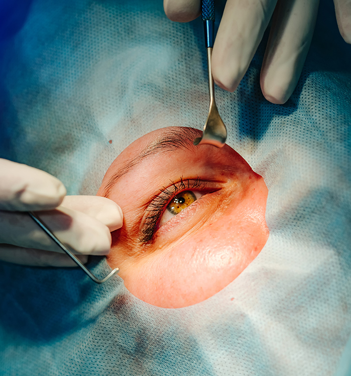 Medical specialist performing surgery ophtalmology operation. Modern equipment. Vision correction.